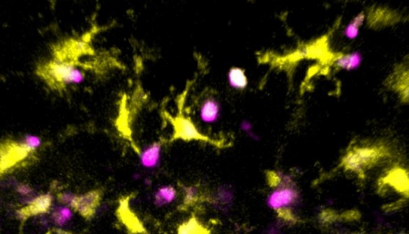 Dendritic Cells Testing T-Cells for Autoreactivity (IMAGE)