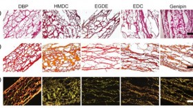 Histological Study of Intact and Cross-Linked Decellularized Bovine Pericardium (IMAGE)