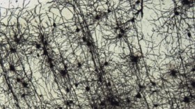 Neurons (IMAGE)