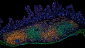 Immune Cells in the Intestine of a Young Mouse (IMAGE)