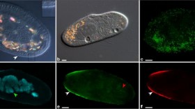 Invasion of a Paramecium Cell by Deaniraea Bacteria (IMAGE)