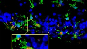 C3 Expression Occurs in Context of Photoreceptor Degeneration (IMAGE)