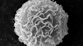 Macrophage (IMAGE)