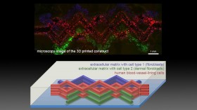 3d bioprinting 