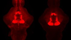 Serotonin in the Zebrafish Brain (IMAGE)