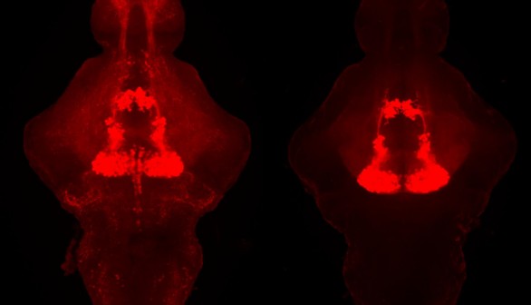 Serotonin in the Zebrafish Brain (IMAGE)