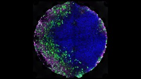 Colony of Human Embryonic Stem Cells (IMAGE)