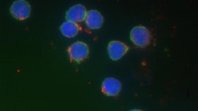 B Lymphocytes (IMAGE)