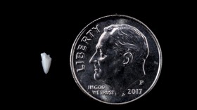 Tooth Fragment Embedded in Foot Solves 25-Year-Old Shark Bite Mystery (IMAGE)