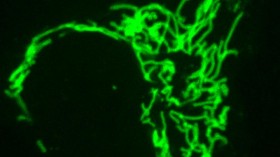 Frankenbody Mitochondria (IMAGE)