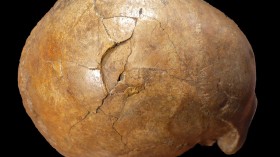 Murder in the Paleolithic? Evidence of Violence behind Human Skull Remains (IMAGE)