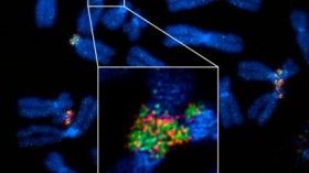 SIM Images of Mitotic Chromosomes (IMAGE)