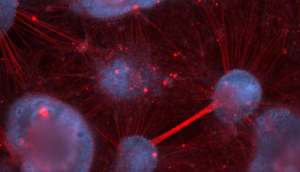 Image of Human Sensory Neurons (IMAGE)