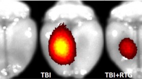 Novel Therapy Administered after TBI Prevents Brain Damage (IMAGE)