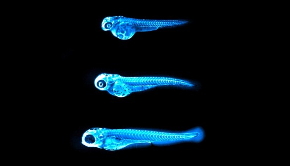 Glowing Cholesterol in Zebrafish (IMAGE)