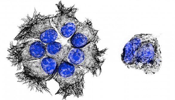 Pancreatic Cancer Cells (IMAGE)