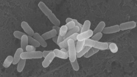 E. coli from Cattle (IMAGE)