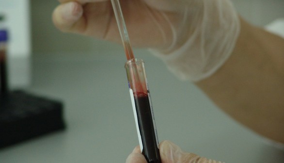 Blood test