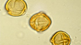 Pollen Under the Microscope (Three Grains)