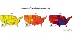 Obesity in America