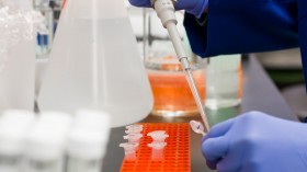 Common FAQs About Protein Purification