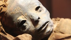 Egyptian Mummy Found to House a Mummified Human Fetus  with a Rare Birth Defect