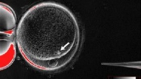 The process by which scientists created patient-specific stem cell lines out of the skin cells of two adult men. 