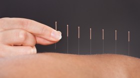The Needling Questions: The Benefits and Methodology of Acupuncture