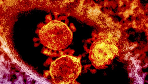 Middle East respiratory syndrome (MERS) coronavirus 