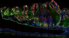 Cross-section of a mouse skin tumour