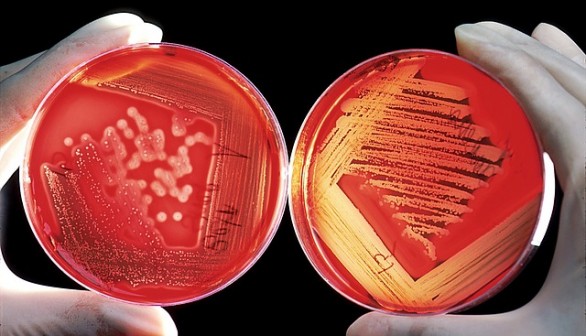 Bacteria, Sample, Petre Dish