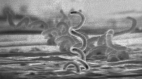 Electron micrograph of Treponema pallidum (syphilis)