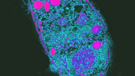 Toxoplasma gondii