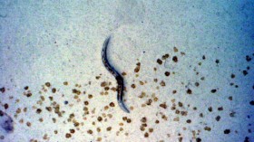 Worms undergo examination
