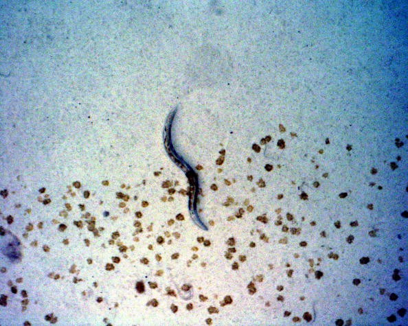 Worms undergo examination