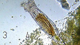 bdelloid rotifer