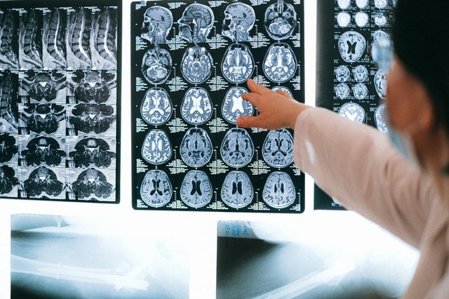 A patient's brain scan