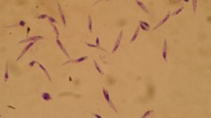 Leishmania 