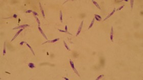 Leishmania 