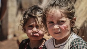 Leishmaniasis disease spreads in refugee camps in Idlib