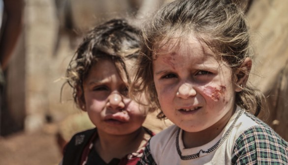 Leishmaniasis disease spreads in refugee camps in Idlib