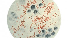 Yersinia pestis