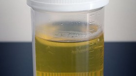 Urine Sample