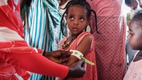 Girl measured at a malnutrition center 