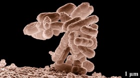 E.Coli