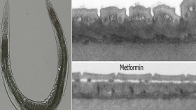 Roundworms treated with metformin show very limited size loss and no wrinkling. | © Wouter De Haes (one time use)