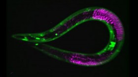 The nematode worm C. elegans with muscle cells fluorescently labeled in green and germ cells fluorescently labeled in red. These cells and others pause at a checkpoint in development and slow their aging when worms encounter a period of starvation.