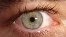 EYE