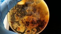 Person in white long sleeve shirt holding blue ceramic plate with bacteria