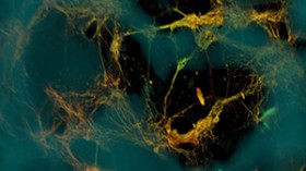 Confocal microscope image of neurons (greenish yellow) attached to silk-based scaffold (blue). The neurons formed functional networks throughout the scaffold pores (dark areas).